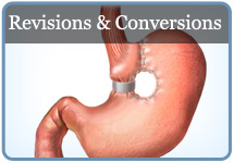Bariatric Revisions and Conversions